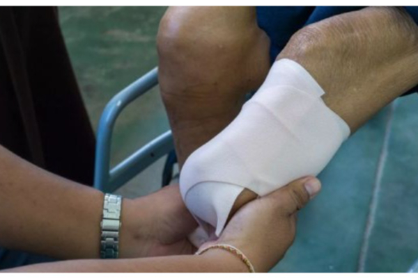 பிரசவத்தில் பயங்கரம் - குழந்தை பிறந்த 2 நாளில் தாய்க்கு பறிபோன கை, கால்கள் | Woman Lost Hands And Feet Due To Delivery America