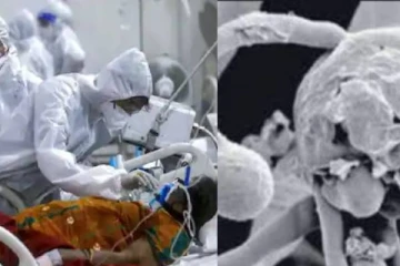 இந்தியாவில் வெள்ளைப் பூஞ்சை நோய் 4 பேருக்கு கண்டுபிடிப்பு! கருப்புப் பூஞ்சையை விட ஆபத்தானது என பகீர் தகவல்