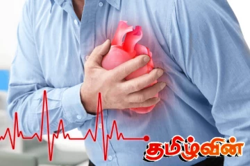 இலங்கையில் இளைஞர்கள் மத்தியில் அதிகரிக்கும் மாரடைப்பு : விடுக்கப்பட்ட எச்சரிக்கை