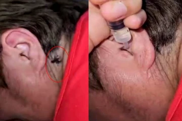 Viral Video: காது வலி என சென்ற நபருக்கு காத்திருந்த அதிர்ச்சி! காதுக்குள் இருந்து வெளியே வந்த சிலந்தி