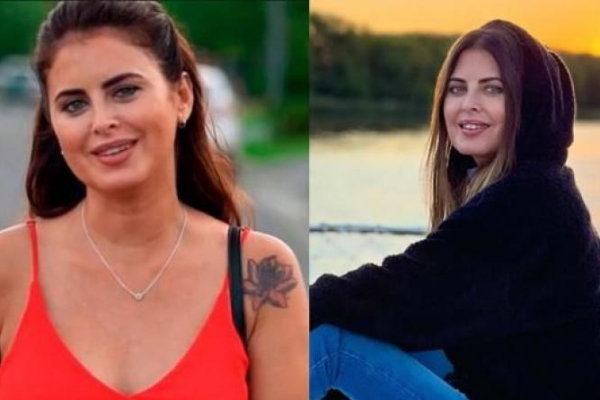 plastic-surgery-cause-death-to-argentina-actress:அர்ஜெண்டினாவின் பிரபல நடிகை சில்வினா லூனா மரணம்: பிளாஸ்டிக் சர்ஜரியால் ஏற்பட்ட விபரீதம்
