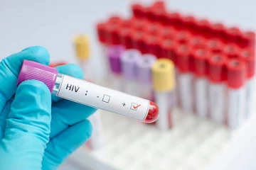 පළමු වරට HIV ආසාදිත කාන්තාවක් සුවය ලබයි............