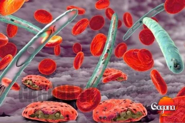 ලංකාවේ නැවතත් මාරාන්තික රෝගයක් හිස ඔසවයි - එක් අයෙකුගේ තත්ත්වය බරපතළ