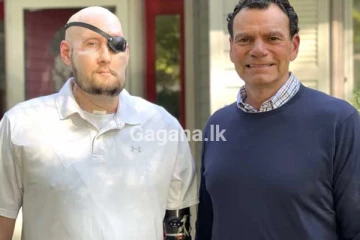 ලොව පළමු සම්පූර්ණ ඇස් බද්ධය සාර්ථක වෙයි - (PHOTOS)