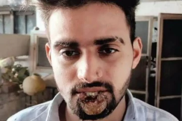 அத்துமீறிய இளைஞரின் உதட்டை கடித்து துப்பிய இளம்பெண்! பின்னர் நடந்த சம்பவம்