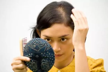 இந்த 5 வீட்டு வைத்தியத்தை செய்தால், உச்சந்தலையில் உள்ள வழுக்கையில் கூட புதிய முடி வளரும்