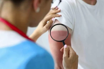 வெயிலால் உங்க சருமம் கருத்துவிட்டதா? அப்போ இதை ட்ரை பண்ணுங்க