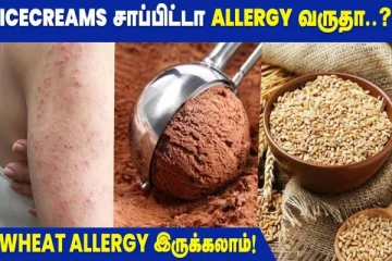 ஐஸ்கிரீம் அதிகமாக சாப்பிட்ட அலர்ஜி வருமா?