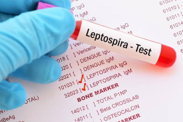 யாழில் பரவும் எலிக்காய்ச்சல் ; மக்களுக்கு விடுத்துள்ள எச்சரிக்கை | Rat Fever Spreading In Jaffna Warning The Public