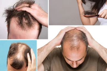 வழுக்கையில கூட முடி வளர வேண்டுமா? இதை மறக்கமால் செய்தாலே போதுமாம்