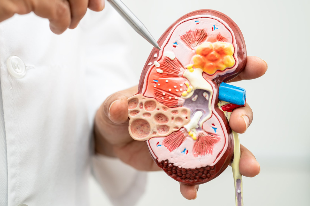 சிறுநீரக கற்களை கரைக்க உதவும் மூலிகை டீ.., எப்படி தயாரிப்பது? | Herbal Tea To Flush Out Kidney Stones In Tamil