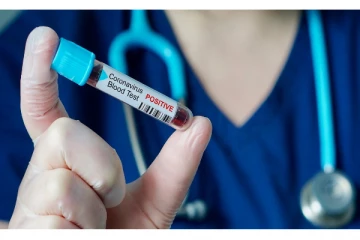 கிளிநொச்சியில் மேலும் 14  பொலிஸாருக்கு கோவிட் தொற்று