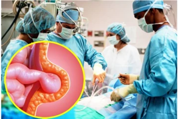 ஆபத்தான குடல் இறக்கமா? உடனே சிகிச்கை செய்யுங்க! ஹெர்னியா எதனால்? ஏன்? யாருக்கு?