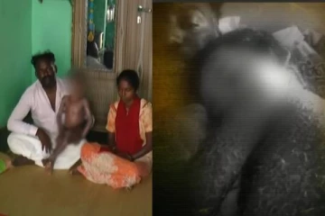 8 வருடமாக பாம்பு போல் தோல் உரியும் சிறுவன்! வேதனையில் பெற்றோர்.. காரணம் என்ன?