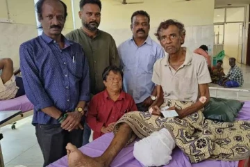 ஒரு காலை இழந்த லொள்ளு சபா நிகழ்ச்சி பிரபலம்.. மருத்துவமனையில் அனுமதி