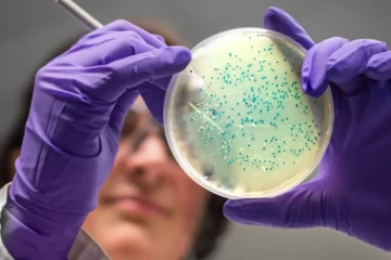 இலங்கையில் Listeria நோயால் பெண்ணொருவர் பலி!