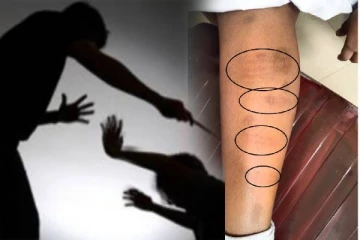 எல்லைமீறும் ஆசிரியர்களின் கண்டிப்பு ; 8வயது மாணவி தாக்கிய ஆசிரியர்