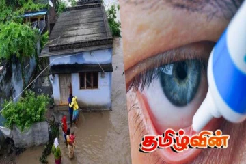 இலங்கையர்களுக்கு ஏற்பட்டுள்ள மற்றுமொரு ஆபத்து: அறிகுறிகள் தென்படுபவர்களுக்கு எச்சரிக்கை