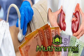 சிறுநீரக நோயாளர்களுக்கான கொடுப்பனவு தொடர்பில் வெளியாகியுள்ள தகவல்