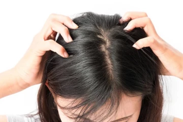 தலையில் பேன் தொல்லையால் பெரும் அவதியா? இதனை போக்க சூப்பர் டிப்ஸ்