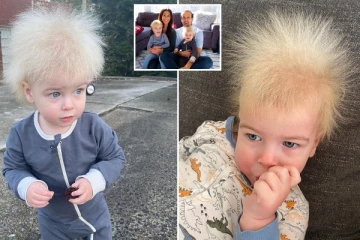 அரிய வகை நோயால் பாதிக்கப்பட்ட சிறுமி!