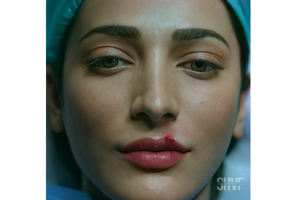 உதட்டில் இரத்த காயத்துடன் கமல் மகள் நடிகை ஸ்ருதி ஹாசன்.. என்ன ஆச்சு மேடம் | Sruthi Haasan With Blood In Lips