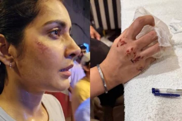 ரத்த காயத்துடன் போட்டோ!! விபத்தில் சிக்கினாரா பிரபல நடிகை ராஷி கண்ணா..