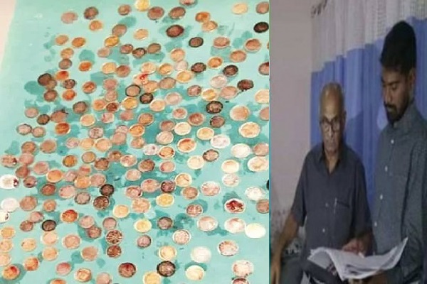 முதியவரின் வயிற்றில் கிடந்த பெருமளவு நாணயங்கள் -மருத்துவர்களுக்கு அதிர்ச்சி | Remove 187 Coins From Old Man Stomach