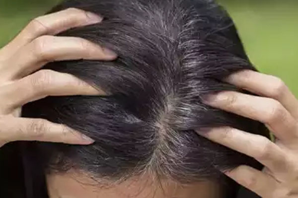 முலாம்பழ விதைகளை இப்படி சாப்பிட்டா ஆயுள் அதிகரிக்குமாம் | Eating Melon Seeds Increase Your Life