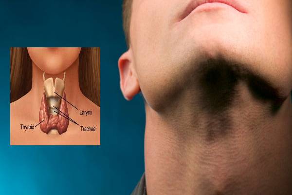 அலட்சியப்படுத்தவே கூடாத தைராய்டு புற்றுநோயின் ஆரம்ப அறிகுறிகள்! | What Are The First Symptoms Of Thyroid Cancer
