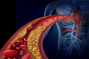 உங்களுக்கு கொலஸ்ரோல் இருக்கா? அப்போ இனி இந்த உணவுகளிடம் இருந்து தூரவே இருங்க!
