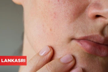 சரும துளைகள் பிரச்சனையை நீக்கி முகத்தை பொலிவாக்க வேண்டுமா? அப்போ வீட்டில் இருக்கும் இந்த பொருட்களை பயன்படுத்துங்கள்