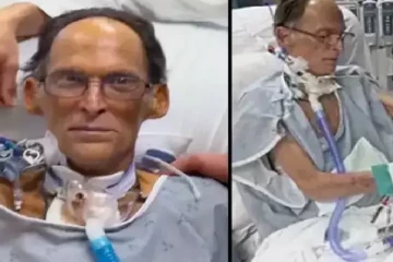 நாடி துடிப்பே இல்லாமல் நபர் உயிர் வாழ்ந்துள்ள அதிசயம்