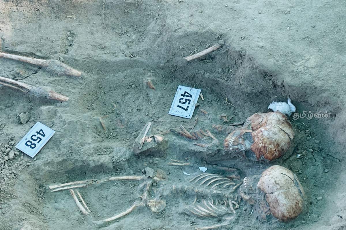 செம்மணியில் இன்று 04 என்புக் கூடுகள் அடையாளம் | 04 Skeletons Identified In Semmani Today செம்மணியில் இன்று 04 என்புக் கூடுகள் அடையாளம் | 04 Skeletons Identified In Semmani Today