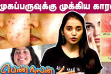 ஒரே இரவில் Pimples போக்க வேண்டுமா? அப்ப இந்த வழிகளை ட்ரை பண்ணுங்க...