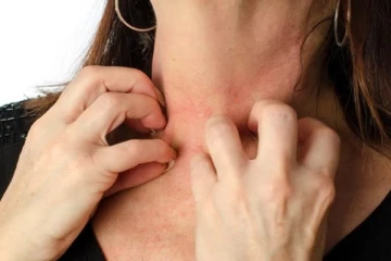 உடலில் ஏற்படக்கூடிய ஒவ்வாமையை குறைக்கக்கூடிய அலர்ஜி கசாயம்