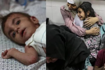 காஸாவில் பிஞ்சு சிறார்களில் பரவும் மிக ஆபத்தான தோல் வியாதி: எச்சரிக்கும் WHO