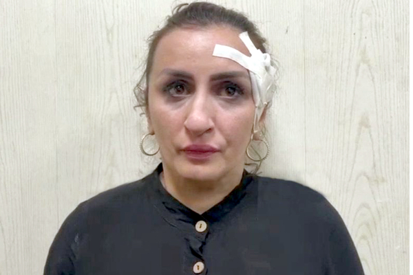 இது தேவையா? மூக்கை அழகுபடுத்த பிறந்து 5 நாளான குழந்தையை விற்ற தாய்! | Russian Woman Arrested For Selling Her Five Day