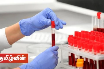 பிரித்தானியாவில் மீண்டும் உருமாறிய கோவிட் - 19 வைரஸ்! தடுப்பூசிகளுக்கு கட்டுப்படாது என்கிறனர் விஞ்ஞானிகள்