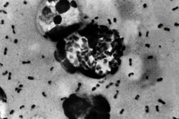 மங்கோலியாவில் பரவி வரும் பிளேக் நோய்