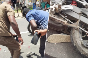 யாழில் மோட்டார் சைக்கிள் விபத்து: இளைஞனின் கால் பாதம் துண்டிப்பு