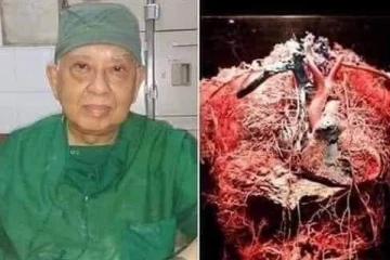 නොසැලකිලිමත්කම නිසා මියගියත් පිළිකාවෙන් බේරෙන්නේ පුළුවන් බව ඔබ දන්නවද?