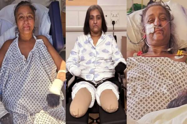 நாய் நக்குவதால் செப்சிஸ் எனப்படும் ஆபத்தான நோய் - இது எப்படி தொற்றும்? | Dog Lick Caused Dangerous Disease Sepsis Ymptoms