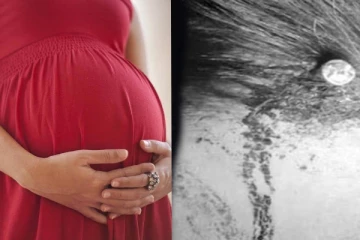 ගැහැණු දරුවා පිරිමි දරුවෙකු වෙන්නැයි හිසට ඇණ ගසා ගත් ගැබිණි මව නුලෙන් බේරුණු හැටි මෙන්න.(PHOTOS)