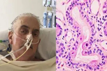 பன்றியின் இதயம் பொருத்தப்பட்டு இறந்தவரின் இதயத்தில் புதிய வைரஸ் - ஆராய்ச்சியில் அதிர்ச்சி தகவல்