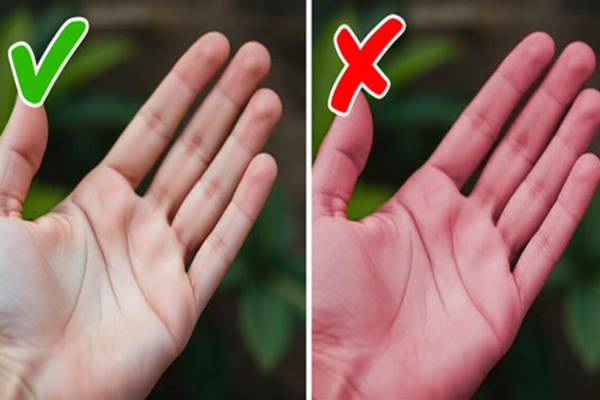 கைகளை வைத்தே உங்க ஆரோக்கியத்தை தெரிஞ்சிக்கலாம்... எப்படினு தெரியுமா? | Your Hand Says Your Health Condition கைகளை வைத்தே உங்க ஆரோக்கியத்தை தெரிஞ்சிக்கலாம்... எப்படினு தெரியுமா? | Your Hand Says Your Health Condition