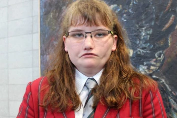 சிரிக்க முடியாது...கருவிழியை அசைக்க முடியாது: விநோத நோயுடன் போராடும் இளம்பெண்