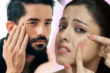 முகப்பருக்களால் கவலையா! தடுக்க  மிக மிக எளிய வழி