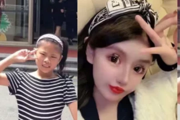 13 வயதில் விபரீத ஆசை - 4 கோடிக்கு 100 பிளாஸ்டிக் சர்ஜரிகள் - அடையாளமே தெரியாமல் போன சிறுமி