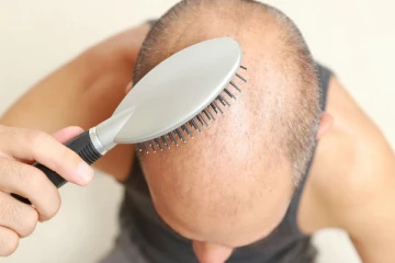 சொட்டை விழுந்த இடத்தில் இதை ஒரு துளி விடுங்க... அடர்த்தியா முடி கிடுகிடுனு வளரும்!